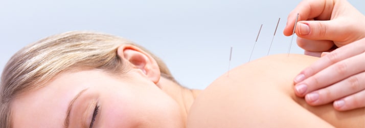 Acupuncture in Crosby MN